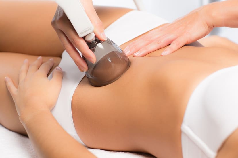 Vacuum Therapy - Beauty by Sol