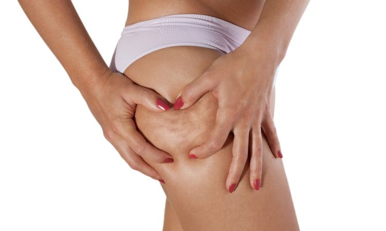 Anti Cellulite Treatment - Beauty by Sol